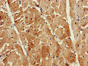 Immunohistochemistry of paraffin-embedded human heart tissue using CSB-PA012203LA01HU at dilution of 1:100