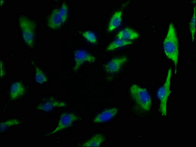 Immunofluorescence staining of U251 cells with CSB-PA012218NA01HU at 1:50, counter-stained with DAPI. The cells were fixed in 4% formaldehyde, permeabilized using 0.2% Triton X-100 and blocked in 10% normal Goat Serum. The cells were then incubate...