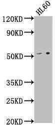 Western Blot Positive WB detected in: HL60 whole cell lysate All lanes: LCHN antibody at 1:1000 Secondary Goat polyclonal to rabbit IgG at 1/50000 dilution Predicted band size: 52 kDa Observed band size: 52 kDa