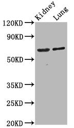 Western Blot Positive WB detected in: Rat kidney tissue, Mouse lung tissue All lanes: SRRM4 antibody at 4.2ug/ml Secondary Goat polyclonal to rabbit IgG at 1/50000 dilution Predicted band size: 69 kDa Observed band size: 69 kDa