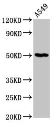 Western Blot Positive WB detected in: A549 whole cell lysate All lanes: GDI1 antibody at 6µg/ml Secondary Goat polyclonal to rabbit IgG at 1/50000 dilution Predicted band size: 51 kDa Observed band size: 51 kDa