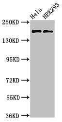 Western Blot Positive WB detected in: Hela whole cell lysate, HEK293 whole cell lysate All lanes: KIDINS220 antibody at 3µg/ml Secondary Goat polyclonal to rabbit IgG at 1/50000 dilution Predicted band size: 197, 186, 116, 195, 60 kDa Observed ban...