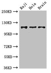 Western Blot Positive WB detected in: Raji whole cell lysate, Hela whole cell lysate, Mouse brain tissue All lanes: KIF11 antibody at 3.5ug/ml Secondary Goat polyclonal to rabbit IgG at 1/50000 dilution Predicted band size: 120 kDa Observed band s...