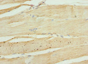 Immunohistochemistry of paraffin-embedded human skeletal muscle tissue using CSB-PA012319ESR1HU at dilution of 1:100