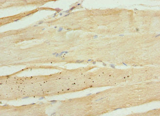Immunohistochemistry of paraffin-embedded human skeletal muscle tissue using CSB-PA012319ESR1HU at dilution of 1:100