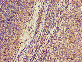 Immunohistochemistry of paraffin-embedded human lymph node tissue using CSB-PA012332LA01HU at dilution of 1:100