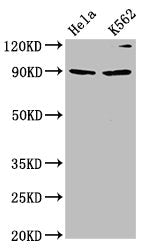 Western Blot Positive WB detected in: Hela whole cell lysate, K562 whole cell lysate All lanes: KIF3C antibody at 4.2µg/ml Secondary Goat polyclonal to rabbit IgG at 1/50000 dilution Predicted band size: 90 kDa Observed band size: 90 kDa
