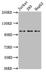 Western Blot Positive WB detected in: Jurkat whole cell lysate, 293 whole cell lysate, HepG2 whole cell lysate All lanes: KIF5B antibody at 3.2µg/ml Secondary Goat polyclonal to rabbit IgG at 1/50000 dilution Predicted band size: 110 kDa Observed...