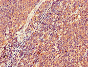 Immunohistochemistry of paraffin-embedded human lymph node tissue using CSB-PA012360LA01HU at dilution of 1:100