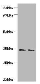 Western blot All lanes: Killer cell immunoglobulin-like receptor 2DS4 antibody at 4ug/ml Lane 1: K562 whole cell lysate Lane 2: Jurkat whole cell lysate Secondary Goat polyclonal to rabbit IgG at 1/10000 dilution Predicted band size: 34 kDa Observ...