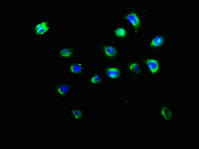 Immunofluorescence staining of A549 cells with CSB-PA012365LA01HU at 1:200, counter-stained with DAPI. The cells were fixed in 4% formaldehyde, permeabilized using 0.2% Triton X-100 and blocked in 10% normal Goat Serum. The cells were then incubat...