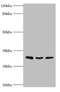 Western blot All lanes: Kit ligand antibody at 4ug/ml Lane 1: HepG2 whole cell lysate Lane 2: Jurkat whole cell lysate Lane 3: Hela whole cell lysate Secondary Goat polyclonal to rabbit IgG at 1/10000 dilution Predicted band size: 31, 28, 27 kDa O...