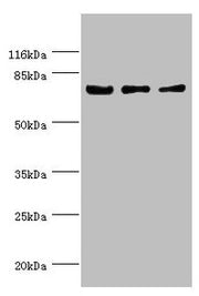 Western blot All lanes: KLC1 antibody at 1.34µg/ml Lane 1: Colo320 whole cell lysate Lane 2: HepG2 whole cell lysate Lane 3: SH-SY5Y whole cell lysate Secondary Goat polyclonal to rabbit IgG at 1/10000 dilution Predicted band size: 66, 64, 65, 72,...
