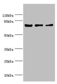 Western blot All lanes: KLC1 antibody at 1.34µg/ml Lane 1: Colo320 whole cell lysate Lane 2: HepG2 whole cell lysate Lane 3: SH-SY5Y whole cell lysate Secondary Goat polyclonal to rabbit IgG at 1/10000 dilution Predicted band size: 66, 64, 65, 72,...