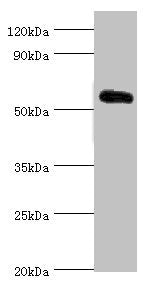 Western blot All lanes: Krueppel-like factor 4 antibody at 5ug/ml + 293T whole cell lysate Secondary Goat polyclonal to rabbit IgG at 1/10000 dilution Predicted band size: 55, 52, 46, 13, 7 kDa Observed band size: 55 kDa
