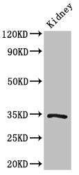 Western Blot Positive WB detected in: Mouse kidney tissue All lanes: KLF7 antibody at 3ug/ml Secondary Goat polyclonal to rabbit IgG at 1/50000 dilution Predicted band size: 34, 30, 25, 31, 14, 10 kDa Observed band size: 34 kDa
