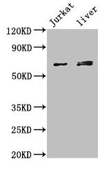 Western Blot Positive WB detected in: Jurkat whole cell lysate, Mouse liver tissue All lanes: KLHL2 antibody at 3µg/ml Secondary Goat polyclonal to rabbit IgG at 1/50000 dilution Predicted band size: 66, 67, 57 kDa Observed band size: 66, 67 kDa
