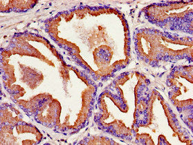Immunohistochemistry of paraffin-embedded human prostate tissue using CSB-PA012453LA01HU at dilution of 1:100