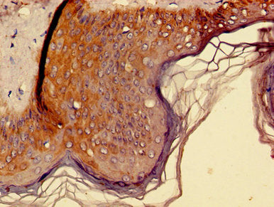 Immunohistochemistry of paraffin-embedded human skin tissue using CSB-PA012459LA01HU at dilution of 1:100