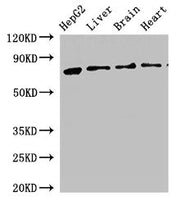 Western Blot Positive WB detected in: HepG2 whole cell lysate, Rat liver tissue, Rat brain tissue, Mouse heart tissue All lanes: KLKB1 antibody at 2.5ug/ml Secondary Goat polyclonal to rabbit IgG at 1/50000 dilution Predicted band size: 72 kDa Obs...