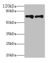 Western blot All lanes: Klkb1 antibody at 2µg/ml Lane 1: Hela whole cell lysate Lane 2: Rat brain tissue Secondary Goat polyclonal to rabbit IgG at 1/10000 dilution Predicted band size: 72 kDa Observed band size: 72 kDa