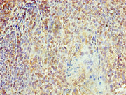 Immunohistochemistry of paraffin-embedded human tonsil tissue using CSB-PA012483LA01HU at dilution of 1:100