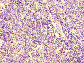Immunohistochemistry of paraffin-embedded human lymph node tissue using CSB-PA012484LA01HU at dilution of 1:100