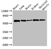 Western Blot Positive WB detected in: Mouse heart tissue, Mouse lung tissue, Mouse brain tissue, Mouse kidney tissue, Mouse skeletal muscle tissue All lanes: KPNA4 antibody at 3.5ug/ml Secondary Goat polyclonal to rabbit IgG at 1/50000 dilution Pr...