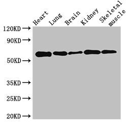 Western Blot Positive WB detected in: Mouse heart tissue, Mouse lung tissue, Mouse brain tissue, Mouse kidney tissue, Mouse skeletal muscle tissue All lanes: KPNA4 antibody at 3.5ug/ml Secondary Goat polyclonal to rabbit IgG at 1/50000 dilution Pr...