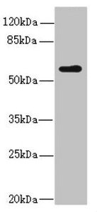 Western blot All lanes: KPNA5 antibody at 2.04ug/ml + Mouse liver tissue Secondary Goat polyclonal to rabbit IgG at 1/10000 dilution Predicted band size: 60 kDa Observed band size: 60 kDa