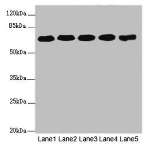 Western blot All lanes: KPNA6 antibody at 4.25ug/ml Lane 1: PC-3 whole cell lysate Lane 2: Hela whole cell lysate Lane 3: U251 whole cell lysate Lane 4: 293T whole cell lysate Lane 5: Mouse brain tissue Secondary Goat polyclonal to rabbit IgG at 1...