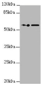 Western blot All lanes: KPNA6 antibody at 0.95µg/ml Lane 1: PC-3 whole cell lysate Lane 2: Hela whole cell lysate Secondary Goat polyclonal to rabbit IgG at 1/10000 dilution Predicted band size: 60 kDa Observed band size: 60 kDa