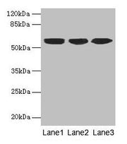 Western blot All lanes: KRT10 antibody at 6µg/ml Lane 1: A431 whole cell lysate Lane 2: HepG2 whole cell lysate Lane 3: MCF-7 whole cell lysate Secondary Goat polyclonal to rabbit IgG at 1/10000 dilution Predicted band size: 59 kDa Observed band s...
