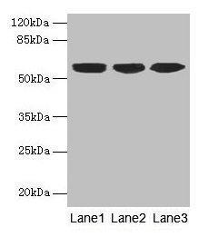 Western blot All lanes: KRT10 antibody at 6µg/ml Lane 1: A431 whole cell lysate Lane 2: HepG2 whole cell lysate Lane 3: MCF-7 whole cell lysate Secondary Goat polyclonal to rabbit IgG at 1/10000 dilution Predicted band size: 59 kDa Observed band s...