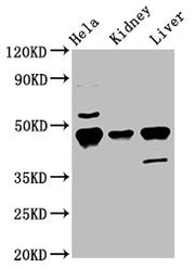 Western Blot Positive WB detected in: Hela whole cell lysate, Mouse kidney tissue, Mouse liver tissue All lanes: Krt18 antibody at 5.5µg/ml Secondary Goat polyclonal to rabbit IgG at 1/50000 dilution Predicted band size: 48 kDa Observed band size:...