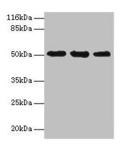 Western blot All lanes: KRT38 antibody at 2µg/ml Lane 1: MCF-7 whole cell lysate Lane 2: Hela whole cell lysate Lane 3: HepG2 whole cell lysate Secondary Goat polyclonal to rabbit IgG at 1/10000 dilution Predicted band size: 51 kDa Observed band s...