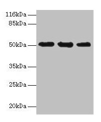 Western blot All lanes: KRT38 antibody at 2µg/ml Lane 1: MCF-7 whole cell lysate Lane 2: Hela whole cell lysate Lane 3: HepG2 whole cell lysate Secondary Goat polyclonal to rabbit IgG at 1/10000 dilution Predicted band size: 51 kDa Observed band s...