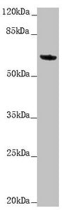 Western blot All lanes: KRT6A antibody at 5.06 ug/ml + Mouse lung tissue Secondary Goat polyclonal to rabbit IgG at 1/10000 dilution Predicted band size: 60 kDa Observed band size: 60 kDa