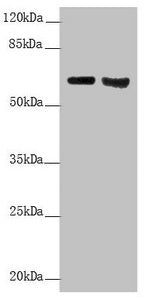Western blot All lanes: KRT6A antibody at 5.82 ug/ml Lane 1: Mouse lung tissue Lane 2: A431 whole cell lysate Secondary Goat polyclonal to rabbit IgG at 1/10000 dilution Predicted band size: 60 kDa Observed band size: 60 kDa