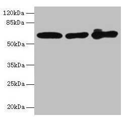 Western blot All lanes: KRT6A antibody at 4µg/ml Lane 1: A431 whole cell lysate Lane 2: K562 whole cell lysate Lane 3: MCF-7 whole cell lysate Secondary Goat polyclonal to rabbit IgG at 1/10000 dilution Predicted band size: 61 kDa Observed band si...