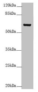 Western blot All lanes: KRT6B antibody at 5.39µg/ml + A431 whole cell lysate Secondary Goat polyclonal to rabbit IgG at 1/10000 dilution Predicted band size: 60 kDa Observed band size: 60 kDa