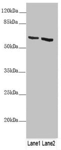 Western blot All lanes: KRT6B antibody at 4.29 ug/ml Lane 1: A431 whole cell lysate Lane 2: A375 whole cell lysate Secondary Goat polyclonal to rabbit IgG at 1/10000 dilution Predicted band size: 60 kDa Observed band size: 60 kDa