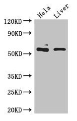 Western Blot Positive WB detected in: Hela whole cell lysate, Mouse liver tissue All lanes: KRT81 antibody at 5µg/ml Secondary Goat polyclonal to rabbit IgG at 1/50000 dilution Predicted band size: 55 kDa Observed band size: 55 kDa