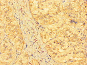 Immunohistochemistry of paraffin-embedded human adrenal gland tissue using CSB-PA012641LA01HU at dilution of 1:100