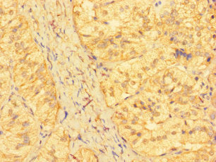 Immunohistochemistry of paraffin-embedded human adrenal gland tissue using CSB-PA012641LA01HU at dilution of 1:100
