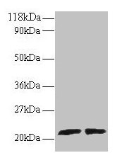 Western blot All lanes: ARL2 antibody at 2µg/ml Lane 1: EC109 whole cell lysate Lane 2: 293T whole cell lysate Secondary Goat polyclonal to rabbit IgG at 1/15000 dilution Predicted band size: 21, 19 kDa Observed band size: 21 kDa