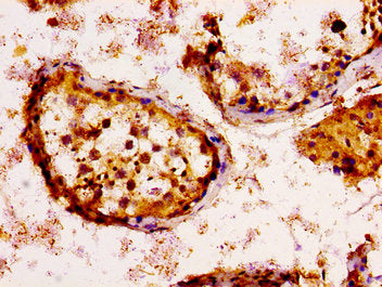 IHC image of CSB-PA012696LA01HU diluted at 1:100 and staining in paraffin-embedded human testis tissue performed on a Leica BondTM system. After dewaxing and hydration, antigen retrieval was mediated by high pressure in a citrate buffer (pH 6.0)....
