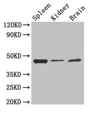 Western Blot Positive WB detected in: Mouse spleen tissue, Mouse kidney tissue, Mouse brain tissue All lanes: LAMP2 antibody at 4µg/ml Secondary Goat polyclonal to rabbit IgG at 1/50000 dilution Predicted band size: 45, 46 kDa Observed band size:...