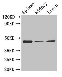 Western Blot Positive WB detected in: Mouse spleen tissue, Mouse kidney tissue, Mouse brain tissue All lanes: LAMP2 antibody at 4µg/ml Secondary Goat polyclonal to rabbit IgG at 1/50000 dilution Predicted band size: 45, 46 kDa Observed band size:...