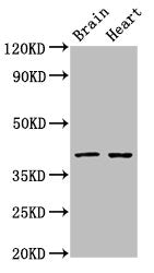 Western Blot Positive WB detected in: Rat brain tissue, Rat heart tissue All lanes: CERS1 antibody at 3ug/ml Secondary Goat polyclonal to rabbit IgG at 1/50000 dilution Predicted band size: 40, 38 kDa Observed band size: 40 kDa